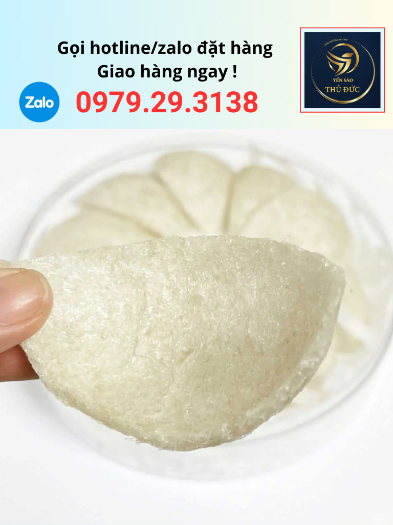 tai-yen-dinh-hinh-5a Tai yến định hình 5A